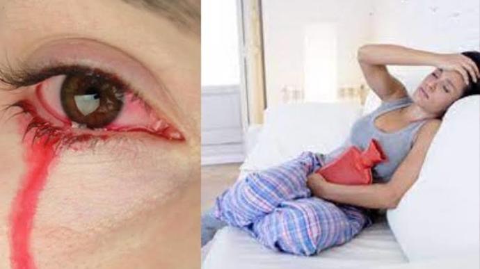 Regl döneminde kan başka bir noktadan vücudunuzu terk etse ne yaparsınız?