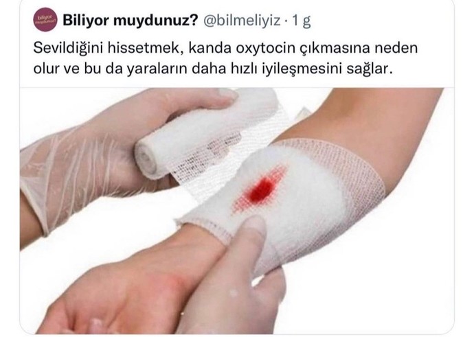 Öpünce geçer mi?