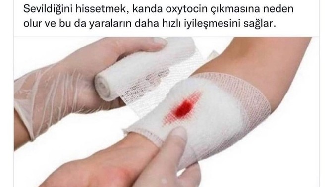 Öpünce geçer mi?