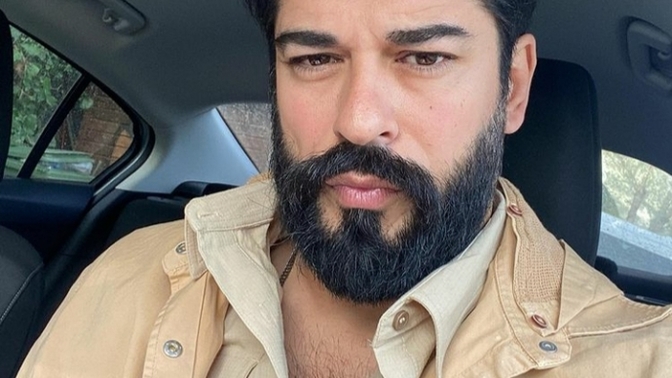 Burak Özçivit'in saçları boya mı sizce?