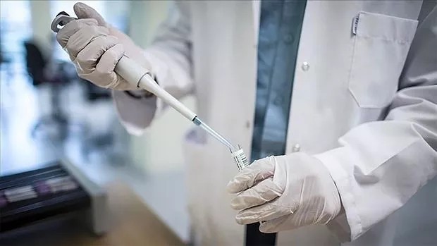 DSÖ acil toplanıyor, gündem maymun çiçeği virüsü! Korkuyor musunuz?