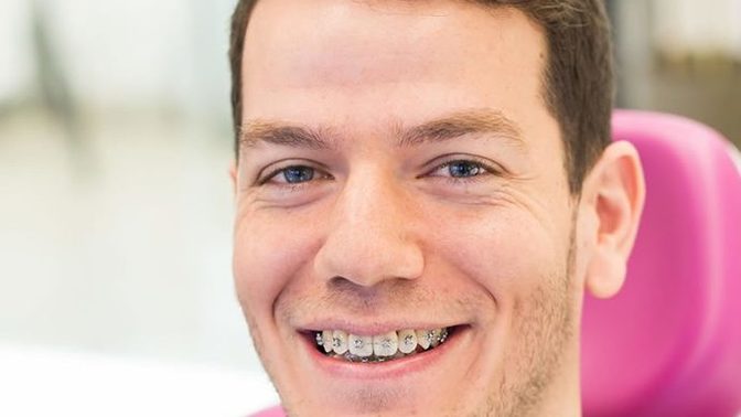 30 yaşında adam diş teli için geç mi kalmıştır?