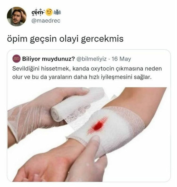 Hastalandığınızda veya yaralandığınızda size Öpeyim de geçsin diyenler oldu mu?