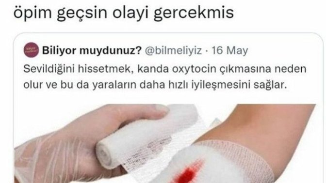 Hastalandığınızda veya yaralandığınızda size "Öpeyim de geçsin" diyenler oldu mu?