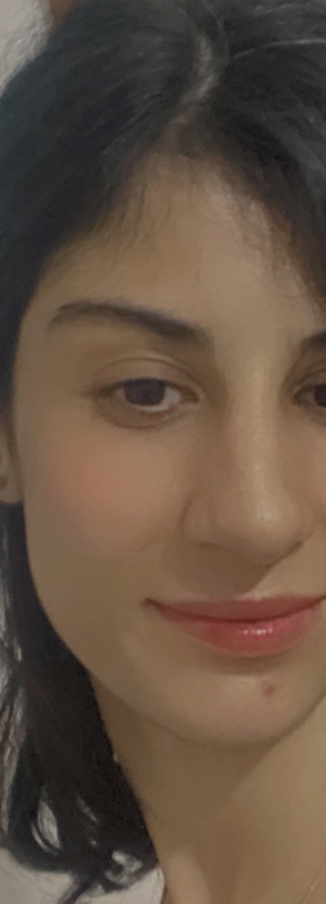 Eşim burnunu yaptıralım dedi, sizce gerek var mı?