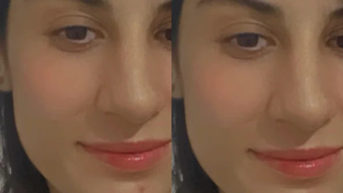 Eşim burnunu yaptıralım dedi, sizce gerek var mı?