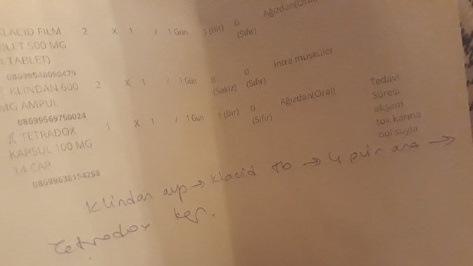 Receteden anlayan var mı?
