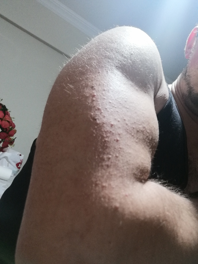 Kollarında böyle bir hastalığı olan var mı?