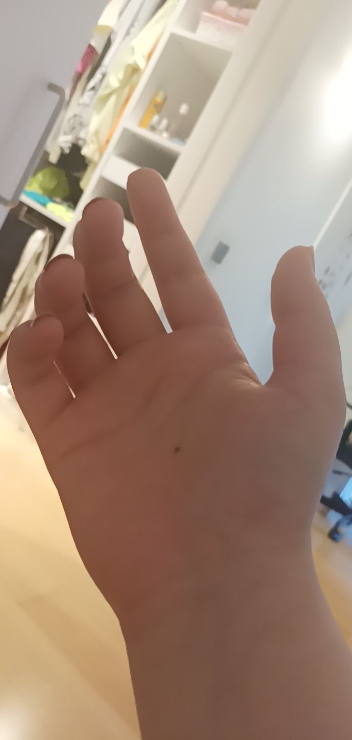 Ellerim çok mu çirkin?