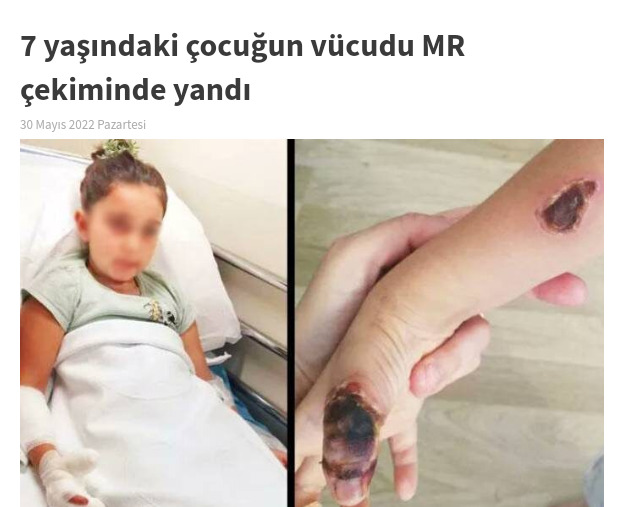 Mr çekiminde çocuğu yakan hastahane yönetimine ne söylemek isterseniz?