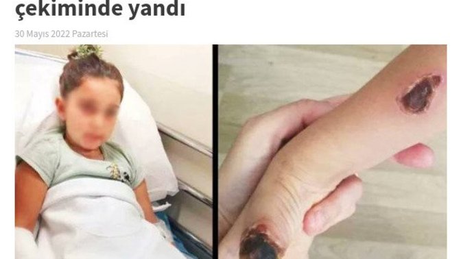 Mr çekiminde çocuğu yakan hastahane yönetimine ne söylemek isterseniz?