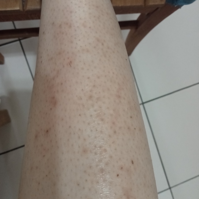 Bacagima bb glow yaptırdım fark var mi?