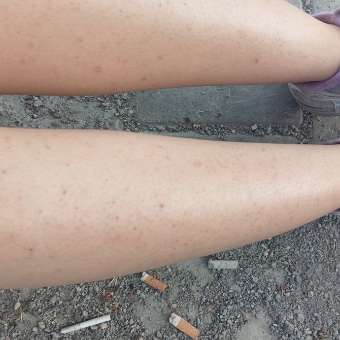 Bacagima bb glow yaptırdım fark var mi?