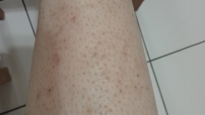 Bacagima bb glow yaptırdım fark var mi?