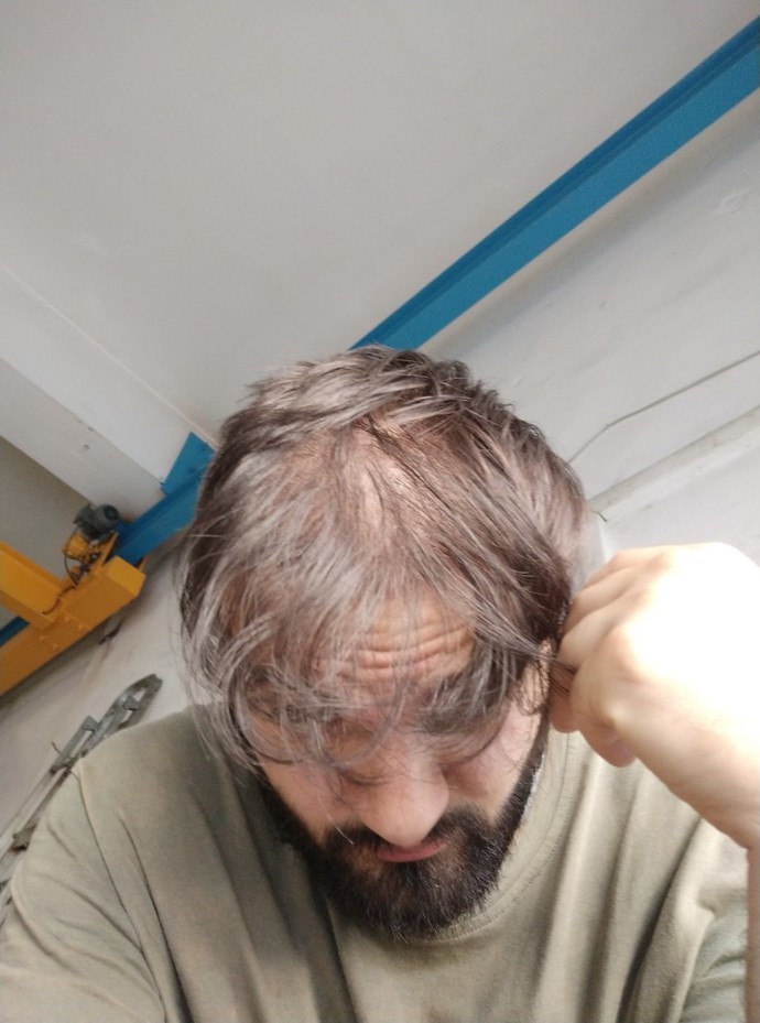 Sizce saçlarımı ektirdim çok mu kötü olmuş?
