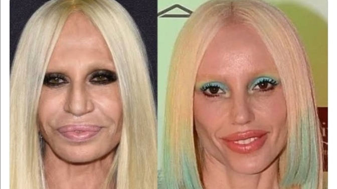 Gülşen, ödül töreninde yeni stiliyle Donatella Versace'ye benzetildi! Sen de benzettin mi?