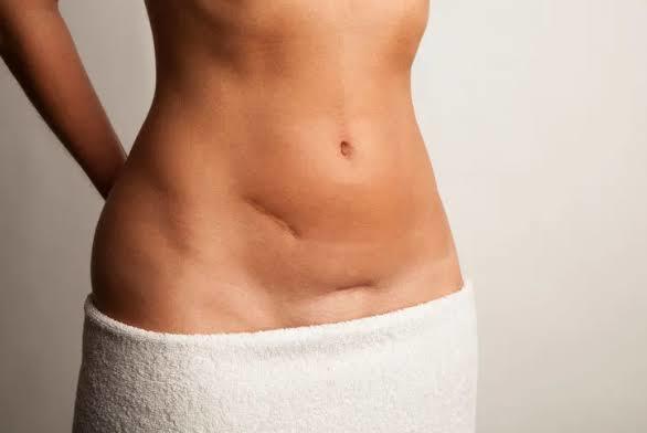 Vücudunuzda dikiş izi var mı? Dikiş izini itici bulur musunuz?