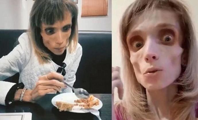 Gülşen'in son hali kime benziyor?