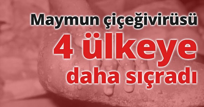 Maymun çiçeği virüsü Türkiye ye sıçradı?