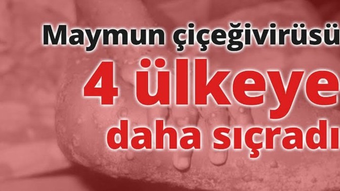 Maymun çiçeği virüsü Türkiye ye sıçradı?