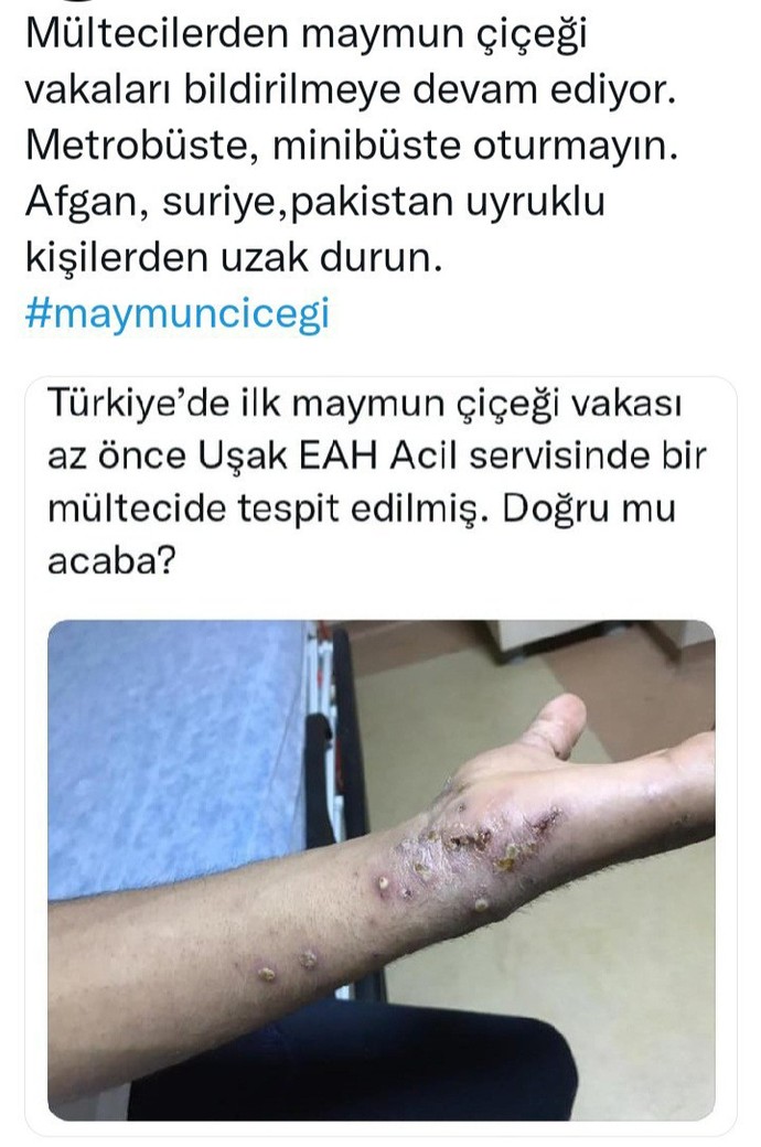 Maymun çiçeği virüsü hakkında neler biliyorsunuz?