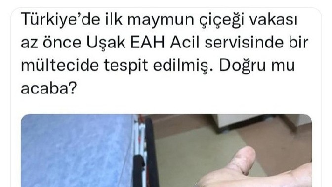 Maymun çiçeği virüsü hakkında neler biliyorsunuz?