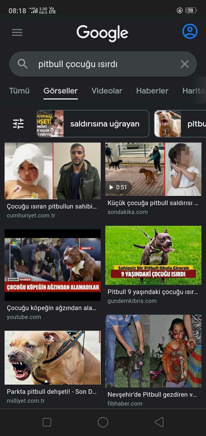 Madem sorun yetiştiricide hayvanda değil neden sadece pitbull cinsi köpeklerin saldırı haberini duyuyoruz?