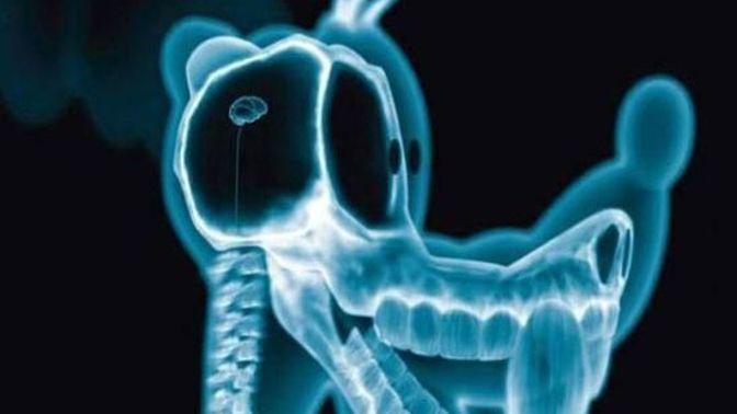 Röntgeni beğenmedi, doktoru dövdü! Sizce röntgen çekmek sağlığa bu kadar zararlı mı?