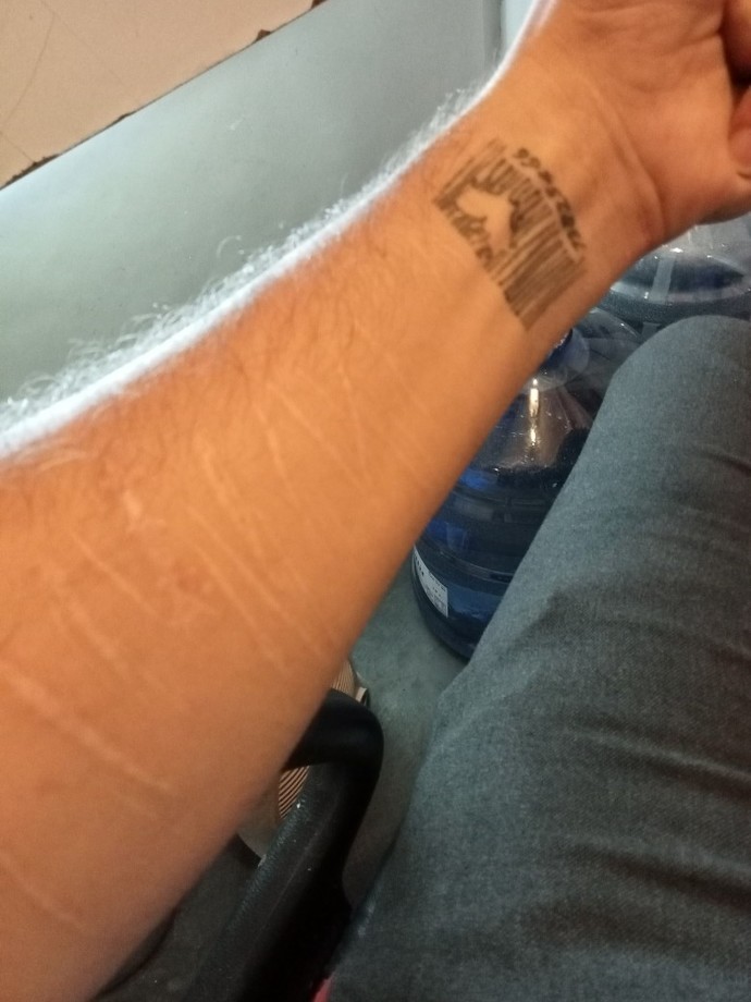 Kedi çizikleri ne kadar sürede geçer?