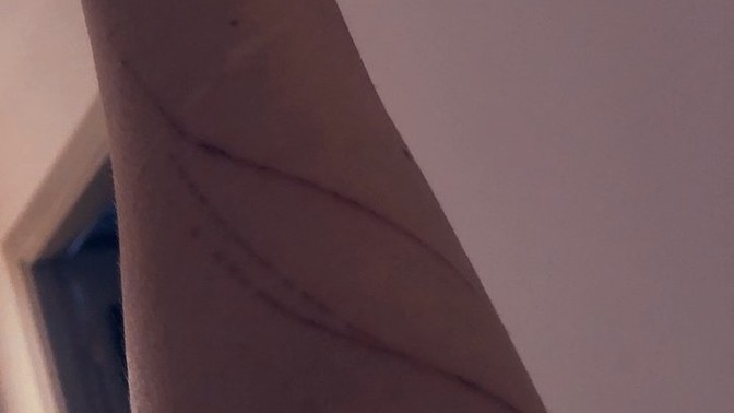Kedi çizikleri ne kadar sürede geçer?
