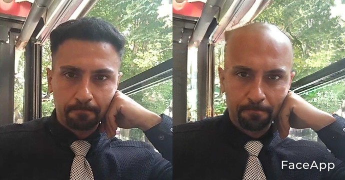 Erkekte saçlar ne kadar önemli, kel bir erkek de çekici olabilir mi?