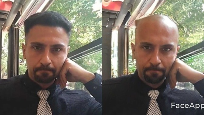 Erkekte saçlar ne kadar önemli, kel bir erkek de çekici olabilir mi?