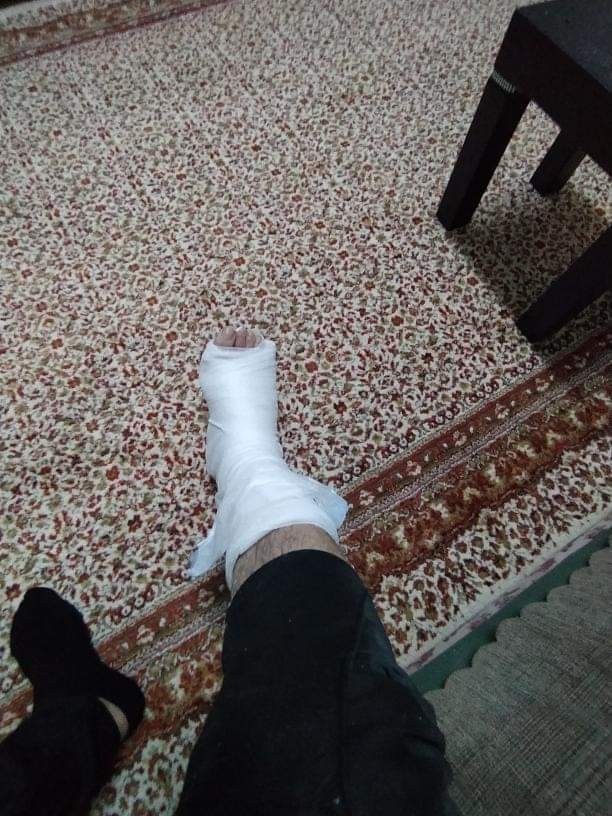 Ayağım kapıya sıkıştı, ne yapmam lazım?