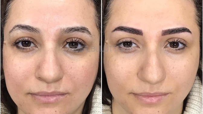 Kalıcı makyaj estetik sınıfına mı girer?