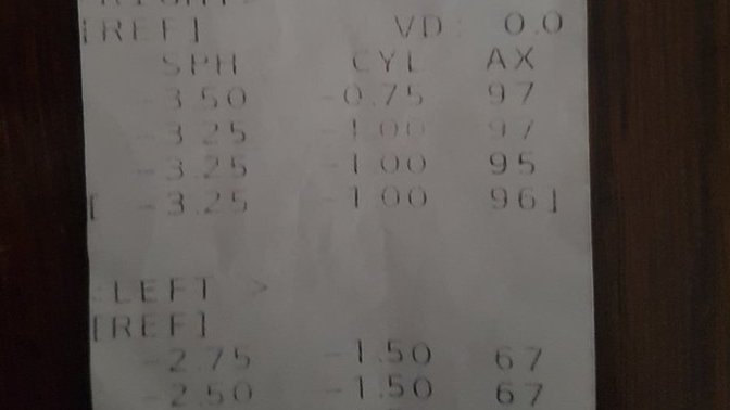 Ggöz numaram nedir ve bana lazer ameliyati yaparlar mi?