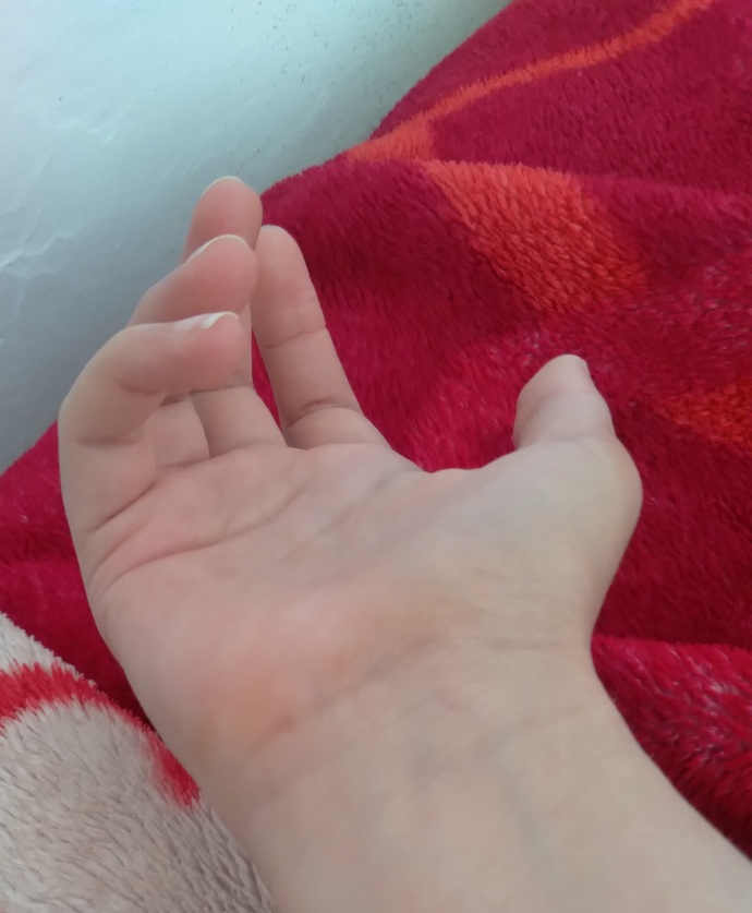 Kurtaj oldum elim sarı şeyler çıktı?