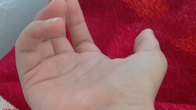 Kurtaj oldum elim sarı şeyler çıktı?