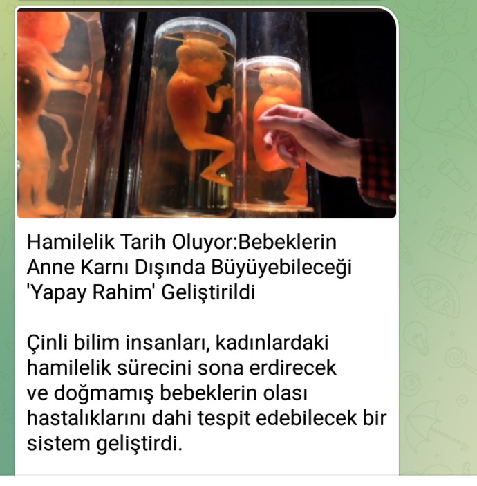 Bebeklerin anne karnı dışında büyüyebileceği Yapay Rahim geliştirildi. Böyle anne olunur mu?