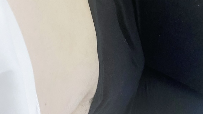 Daha önce zayıflama hastalığınız oldu mu?