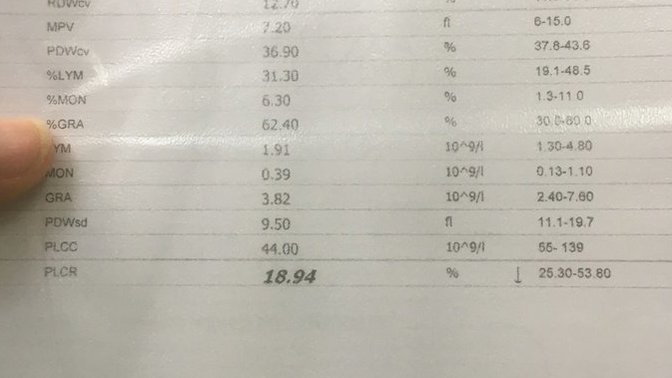 Doktor beni başından saldı ama burada değer düşük gözüktü nedir bilen var mı?