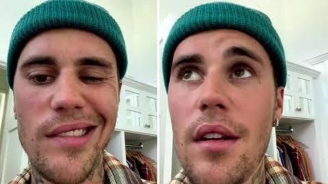Justin bieberin son halini gördünüz mü yüz felci geçirmiş sizce iyimi oldu çok totosu kalkıktı ;) ?