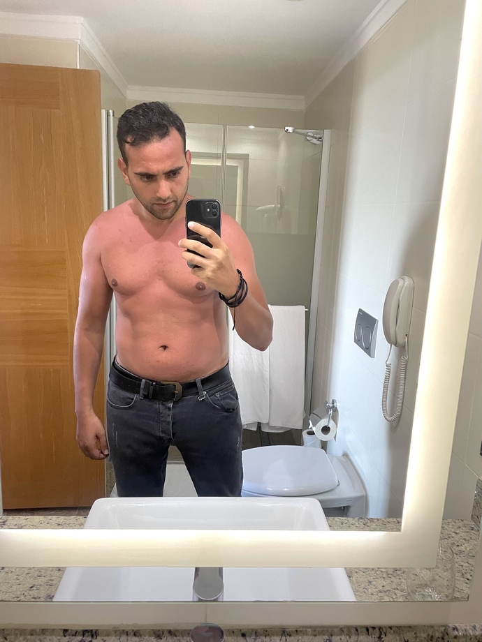 Yaz güzelliği bronzluktan mı geçiyor?