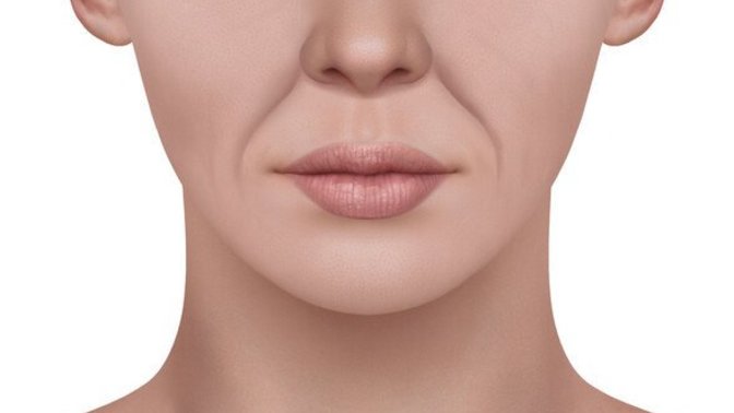 Gencecik yaşımda neden yüzümde kırşıklık çıkıyor?