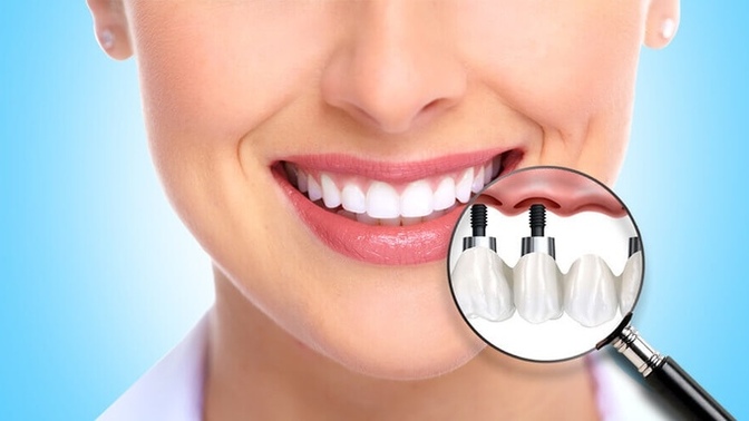 Merhaba implant yaptırmak acı veriyormu?