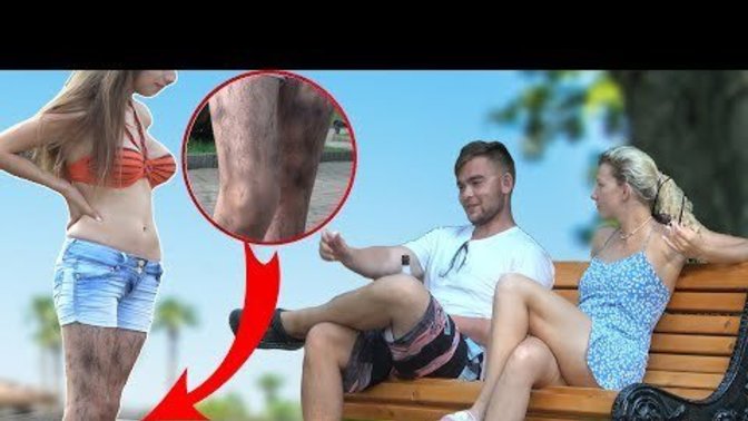 Siz tüylerin alınmamasını nasıl karşılardınız?