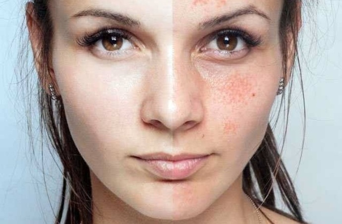 Cildinize en çok zarar veren şey nedir?