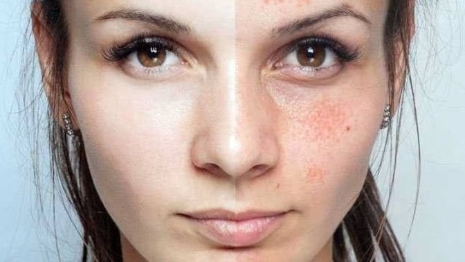 Cildinize en çok zarar veren şey nedir?