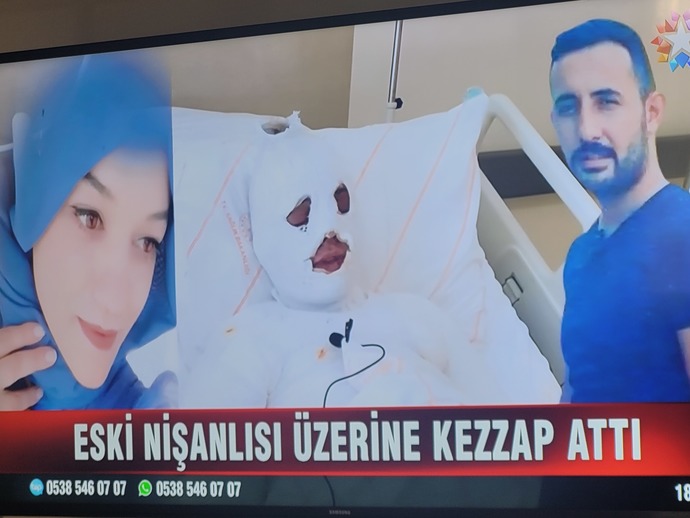 Görselini en iyi ifade eden kısa notunu buraya ekleyebilirsin.