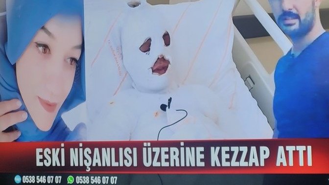 Bazı erkekler neden bu kadar psikopat?
