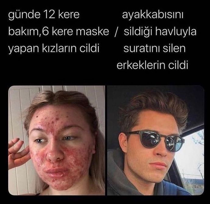 Ayağını sildiği havluyla yüzünü silen erkeklerin cildi neden onca bakım yapan kadınların cildinden daha güzel?